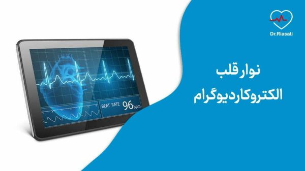 نوار قلب الکتروکاردیوگرام