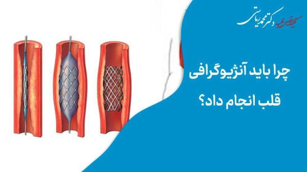 چرا باید آنژیوگرافی‌قلب انجام داد؟