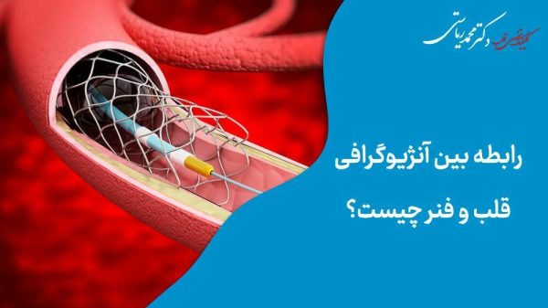 آنژیوگرافی قلب و فنر