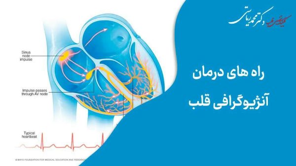راه های درمان آنژیوگرافی قلب