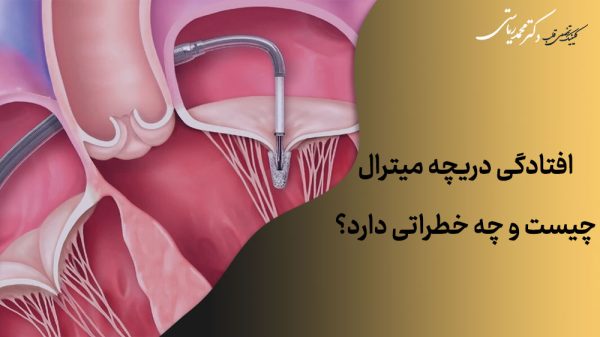 افتادگی دریچه میترال چیست