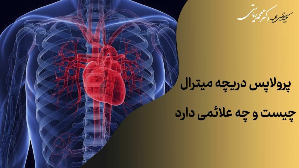 پرولاپس دریچه میترال چیست