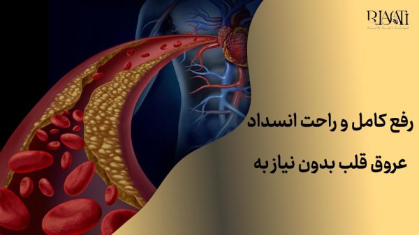 انسداد عروق قلب