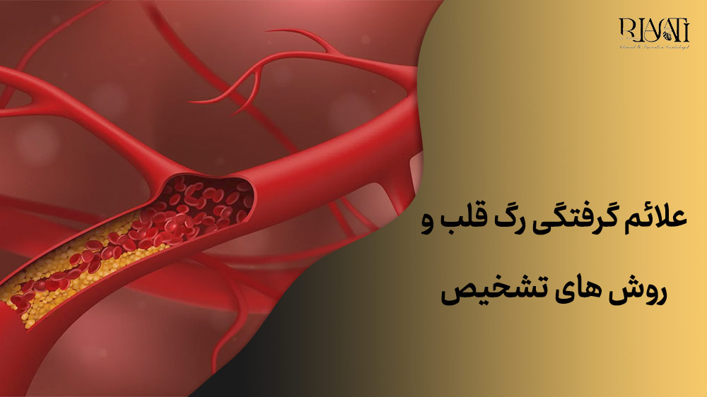 معرفی علائم گرفتگی رگ قلب