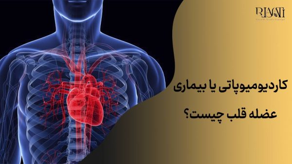 کاردیومیوپاتی یا بیماری عضله قلب چیست