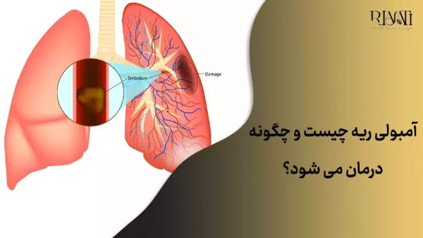 آمبولی ریه چیست؟