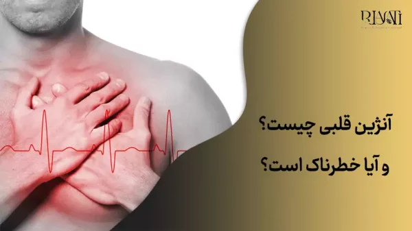 آنژین قلی