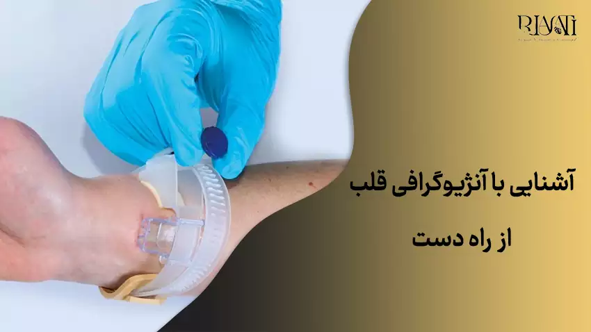 آنژیوگرافی قلب از راه دست