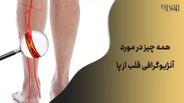 آنژیوگرافی قلب از پا