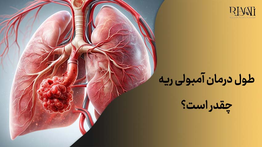 طول درمان آمبولی ریه